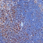 Anti-PI3 Kinase p110 delta antibody produced in rabbit