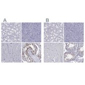 Anti-PPM1G antibody produced in rabbit Prestige Antibodies® Powered by Atlas Antibodies, affinity isolated antibody, buffered aqueous glycerol solution