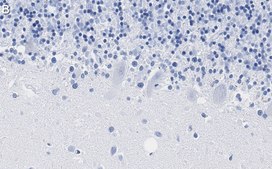 Anti-PKCδ Antibody, clone 1C13 ZooMAb® Rabbit Monoclonal recombinant, expressed in HEK 293 cells