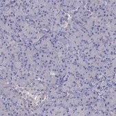 Anti-SCNN1D antibody produced in rabbit Prestige Antibodies® Powered by Atlas Antibodies, affinity isolated antibody, buffered aqueous glycerol solution
