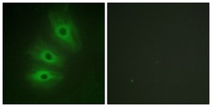 Anti-ADCY5 antibody produced in rabbit affinity isolated antibody