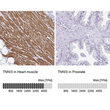 Anti-TNNI3 antibody produced in rabbit Prestige Antibodies® Powered by Atlas Antibodies, affinity isolated antibody, buffered aqueous glycerol solution