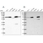 Anti-GBE1 antibody produced in rabbit Prestige Antibodies® Powered by Atlas Antibodies, affinity isolated antibody, buffered aqueous glycerol solution