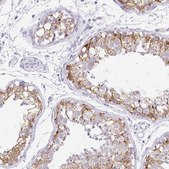 Anti-FATE1 antibody produced in rabbit Prestige Antibodies® Powered by Atlas Antibodies, affinity isolated antibody, buffered aqueous glycerol solution