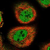 Anti-RRM2B antibody produced in rabbit Prestige Antibodies® Powered by Atlas Antibodies, affinity isolated antibody, buffered aqueous glycerol solution