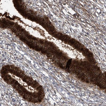 Anti-TXNIP antibody produced in rabbit Prestige Antibodies® Powered by Atlas Antibodies, affinity isolated antibody, buffered aqueous glycerol solution