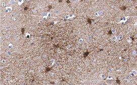 Anti-BLBP/FABP7 Antibody, clone 7I23, ZooMAb® Rabbit Monoclonal recombinant, expressed in HEK 293 cells