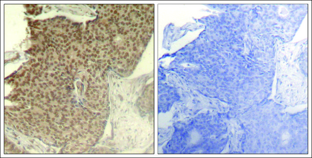 Anti-phospho-HDAC2 (pSer394) antibody produced in rabbit affinity isolated antibody