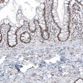 Anti-KMT5C antibody produced in rabbit Prestige Antibodies® Powered by Atlas Antibodies, affinity isolated antibody, buffered aqueous glycerol solution