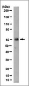 Anti-Keratin K3/K76 Antibody, clone AE5 clone AE5, from mouse