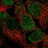 Anti-PSMD3 antibody produced in rabbit Prestige Antibodies® Powered by Atlas Antibodies, affinity isolated antibody, buffered aqueous glycerol solution