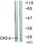 Anti-CKII-β antibody produced in rabbit affinity isolated antibody