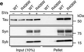 Anti-Synapsin I Antibody Chemicon®, from rabbit