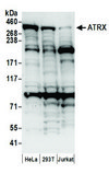 Rabbit anti-ATRX Antibody, Affinity Purified Powered by Bethyl Laboratories, Inc.