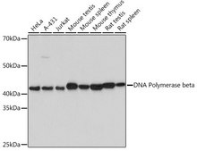 Anti-DNA Polymerase beta antibody produced in rabbit