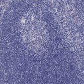 Anti-TGM4 antibody produced in rabbit Prestige Antibodies® Powered by Atlas Antibodies, affinity isolated antibody, buffered aqueous glycerol solution