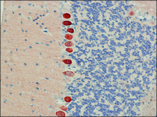 Anti-Calbindin-D-28K (EG-20) antibody produced in rabbit affinity isolated antibody, buffered aqueous solution