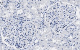 Anti-Wilms Tumor Protein Antibody, clone 2O18 ZooMAb® Rabbit Monoclonal recombinant, expressed in HEK 293 cells