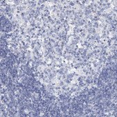 Anti-SLC37A4 antibody produced in rabbit Prestige Antibodies® Powered by Atlas Antibodies, affinity isolated antibody, buffered aqueous glycerol solution
