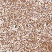 Anti-KCNQ1 antibody produced in rabbit Prestige Antibodies® Powered by Atlas Antibodies, affinity isolated antibody, buffered aqueous glycerol solution