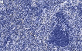 Anti-IL-6 Antibody, clone 1G18 ZooMAb® Rabbit Monoclonal recombinant, expressed in HEK 293 cells