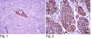 抗-TrkA抗体 Upstate®, from rabbit