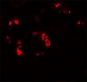 Anti-KANK2 antibody produced in rabbit affinity isolated antibody, buffered aqueous solution