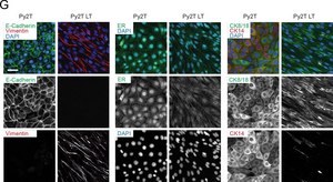 波形蛋白单克隆抗体 小鼠抗 clone LN-6, ascites fluid