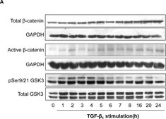 Anti-Active-β-Catenin (Anti-ABC) Antibody, clone 8E7 clone 8E7, Upstate®, from mouse
