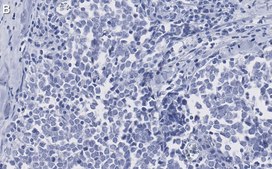 Anti-Myogenin Antibody, clone 1M17 ZooMAb® Rabbit Monoclonal recombinant, expressed in HEK 293 cells