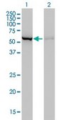 Monoclonal Anti-CBS antibody produced in mouse clone 3E1, purified immunoglobulin, buffered aqueous solution