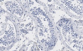 Anti-PKM2 Antibody, clone 1B2 ZooMAb® Rabbit Monoclonal recombinant, expressed in HEK 293 cells