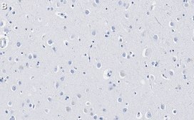 Anti-GAD67 Antibody, clone 4B5 ZooMAb® Rabbit Monoclonal recombinant, expressed in HEK 293 cells
