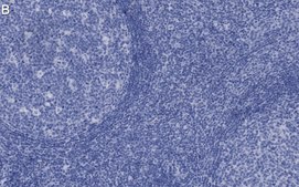 Anti-Syk Antibody, clone 2G22 ZooMAb® Rabbit Monoclonal recombinant, expressed in HEK 293 cells