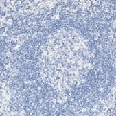 Anti-KCNJ1 antibody produced in rabbit Prestige Antibodies® Powered by Atlas Antibodies, affinity isolated antibody, buffered aqueous glycerol solution