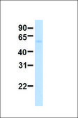Anti-IRF6 antibody produced in rabbit affinity isolated antibody