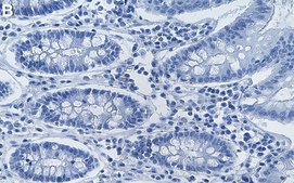 Anti-VHL Antibody, clone 1C10 ZooMAb® Rabbit Monoclonal recombinant, expressed in HEK 293 cells