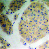 Anti-phospho-PP2A-α (pTyr307) antibody produced in rabbit affinity isolated antibody