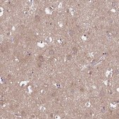 Anti-TLN2 Prestige Antibodies® Powered by Atlas Antibodies, affinity isolated antibody