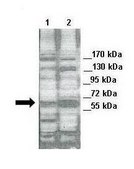 Anti-STK3 antibody produced in rabbit affinity isolated antibody
