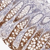 Anti-FABP1 antibody produced in rabbit Prestige Antibodies® Powered by Atlas Antibodies, affinity isolated antibody, buffered aqueous glycerol solution