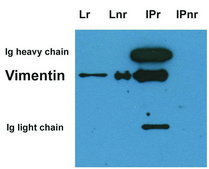 Monoclonal Anti-Vimentin antibody produced in mouse clone VI-10