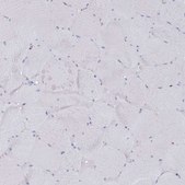 Anti-EPX antibody produced in rabbit Prestige Antibodies® Powered by Atlas Antibodies, affinity isolated antibody, buffered aqueous glycerol solution