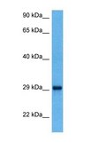 Anti-YWHAQ antibody produced in rabbit affinity isolated antibody