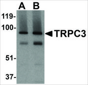 Anti-TRPC3 (ab3) antibody produced in rabbit affinity isolated antibody, buffered aqueous solution