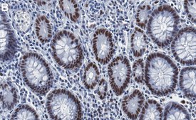 Anti-MLH1 Antibody, clone 1B15 ZooMAb® Rabbit Monoclonal recombinant, expressed in HEK 293 cells