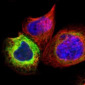 Anti-SCD antibody produced in rabbit Prestige Antibodies® Powered by Atlas Antibodies, affinity isolated antibody, buffered aqueous glycerol solution
