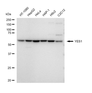 KD-Validated Anti YES1 Antibody, clone 23GB4945, Rabbit Monoclonal clone 23GB4945, recombinant rabbit monoclonal, expressed in HEK293 cells