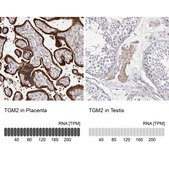 Anti-TGM2 antibody produced in rabbit Prestige Antibodies® Powered by Atlas Antibodies, affinity isolated antibody, buffered aqueous glycerol solution