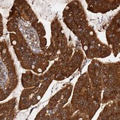 Anti-PRKAB2 antibody produced in rabbit Prestige Antibodies® Powered by Atlas Antibodies, affinity isolated antibody, buffered aqueous glycerol solution